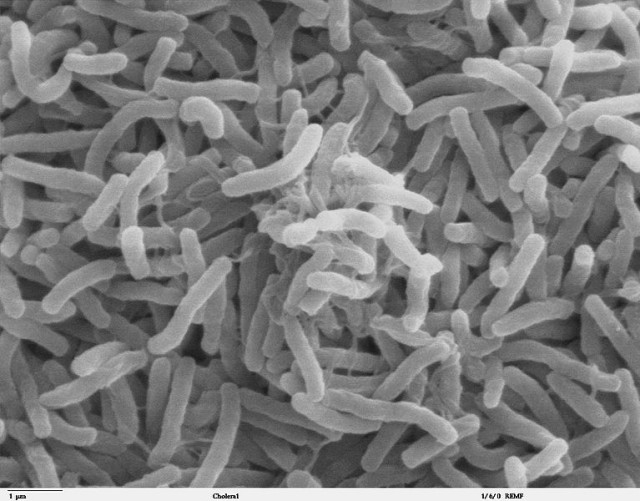 Cholera bacteria @ wikipedia.org
© http://remf.dartmouth.edu/images/bacteriaSEM/source/1.html