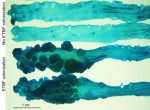CynthiaSears-ETBF-colons @ hopkinskimmelcancercenter.org
© Shaoguang Wu